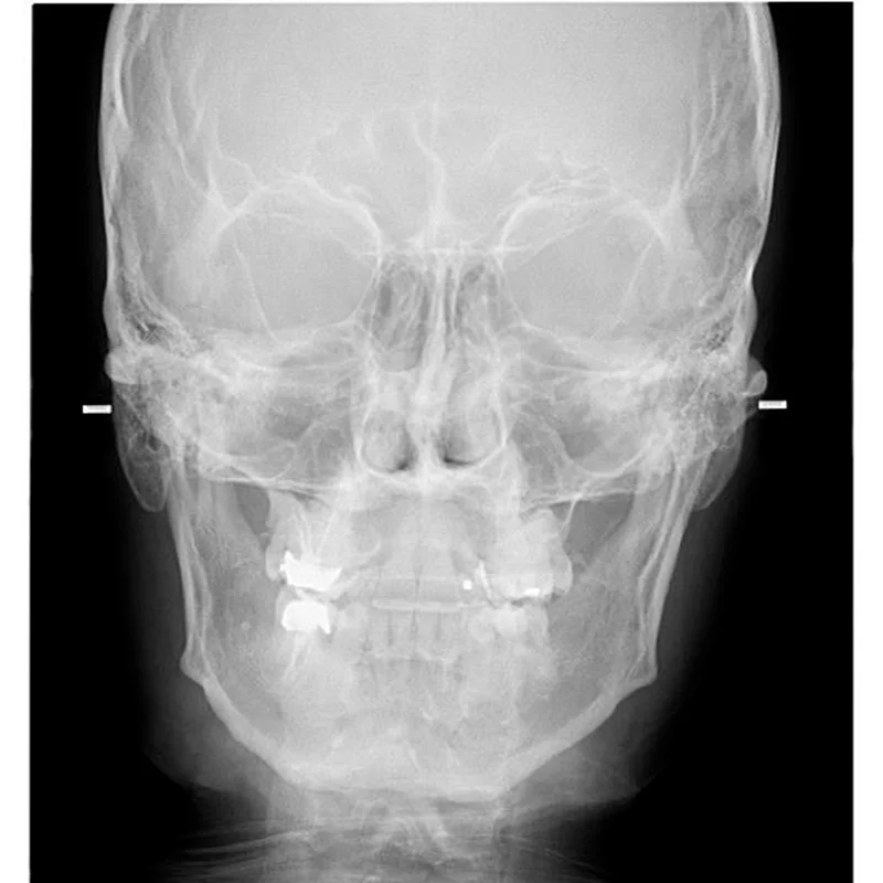 radiografias dentales en queretaro zibata