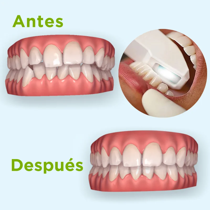 simulador de ortodoncia antes y despues